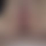 ana* und abspri** Bilder
