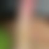 schw**zfoto