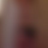 My Back is the new Hack