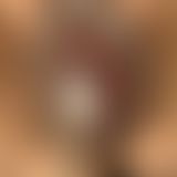 Meine geschwollene musc**