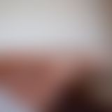 Nackte Haut mit heißen Bikinistreifen