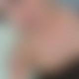 Mitten ins Gesicht!!!