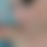 Mitten ins Gesicht!!!