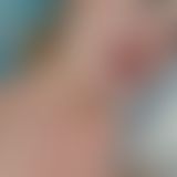 Mitten ins Gesicht!!!