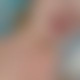 Mitten ins Gesicht!!!