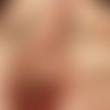 Foly vs Candice bests*xever