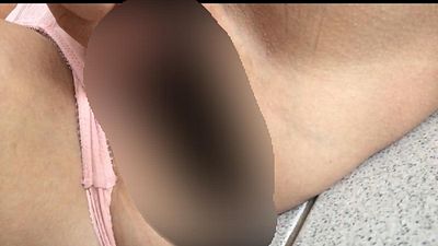 Penisring Veredelung