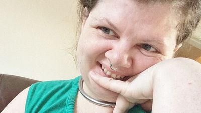 My Cold Sore Mouth Teeth Fetish