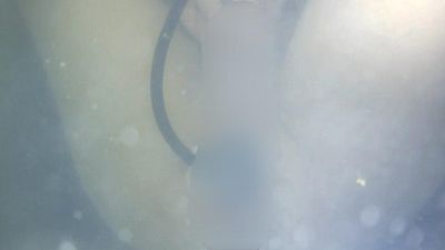 ana*e Explosion - Part 2 (Serie) Short